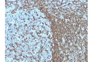 Formalin-fixed, paraffin-embedded human Tonsil stained with CD50 Monoclonal Antibody (ICAM3/1019) (ICAM-3/CD50 antibody)