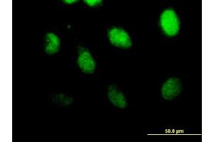 Immunofluorescence of purified MaxPab antibody to CSPG6 on HeLa cell. (SMC3 antibody  (AA 1-1217))