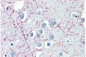 Human Brain, Cortex (formalin-fixed, paraffin-embedded) stained with PLP1 antibody ABIN364261 at 10 ug/ml followed by biotinylated anti-mouse IgG secondary antibody ABIN481714, alkaline phosphatase-streptavidin and chromogen. (PLP1 antibody  (C-Term))