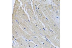 Immunohistochemistry of paraffin-embedded mouse heart using SRI antibody  at dilution of 1:100 (40x lens). (SRI antibody  (AA 1-198))