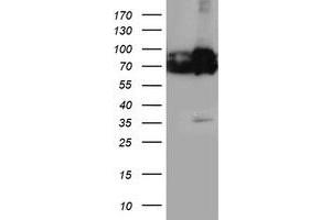 HEK293T cells were transfected with the pCMV6-ENTRY control (Left lane) or pCMV6-ENTRY PDIA4 (Right lane) cDNA for 48 hrs and lysed. (PDIA4 antibody)