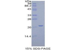 SDS-PAGE (SDS) image for Actin Related Protein 2/3 Complex, Subunit 4, 20kDa (ARPC4) (AA 3-163) protein (His tag) (ABIN2120453) (ARPC4 Protein (AA 3-163) (His tag))