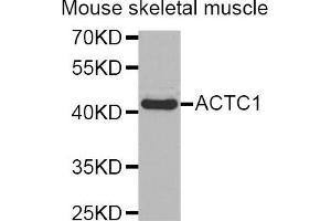 Western blot analysis of extracts of mouse skeletal muscle, using ACTC1 antibody (ABIN5973895). (ACTC1 antibody)