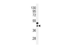 Western blot analysis in mouse bladder tissue lysates (35ug/lane). (CTGF antibody  (AA 134-159))