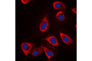 Immunofluorescence (IF) image for anti-Glutamate Receptor, Metabotropic 6 (GRM6) (C-Term) antibody (ABIN7295830)