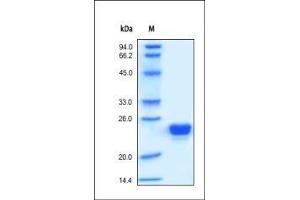 Human Lipocalin-2, His Tag on SDS-PAGE under reducing (R) condition. (Lipocalin 2 Protein (LCN2) (AA 21-198) (His tag))