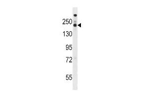 Western blot analysis in WiDr cell line lysates (35ug/lane). (Stromal Antigen 1 antibody  (AA 540-568))