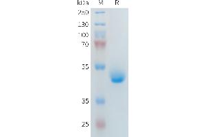 Human R1(21-164) Protein, hFc Tag on SDS-PAGE under reducing condition. (PLA2R1 Protein (AA 21-164) (Fc Tag))