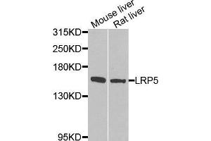 Western blot analysis of extracts of various tissues, using LRP5 antibody. (LRP5 antibody  (AA 1000-1250))