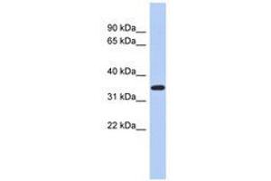 Image no. 1 for anti-Kruppel-Like Factor 6 (KLF6) (AA 71-120) antibody (ABIN6740430) (KLF6 antibody  (AA 71-120))