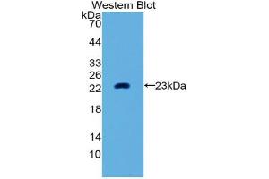 Detection of Recombinant MMP3, Human using Polyclonal Antibody to Matrix Metalloproteinase 3 (MMP3) (MMP3 antibody  (AA 289-452))