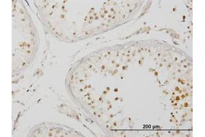 Image no. 1 for anti-Interleukin-1 Receptor-Associated Kinase 4 (IRAK4) (AA 1-130) antibody (ABIN599243) (IRAK4 antibody  (AA 1-130))