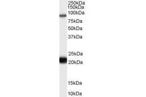 ABIN334473 (0. (RASAL1 antibody  (C-Term))