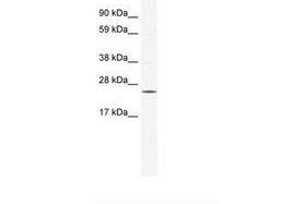 KCTD6 antibody  (AA 72-121)