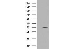 Western Blotting (WB) image for anti-Deoxynucleotidyltransferase, Terminal, Interacting Protein 1 (DNTTIP1) antibody (ABIN1497878) (DNTTIP1 antibody)