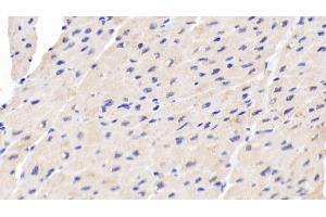 Detection of PIIINP in Human Cardiac Muscle Tissue using Polyclonal Antibody to Procollagen III N-Terminal Propeptide (PIIINP) (PIIINP antibody)