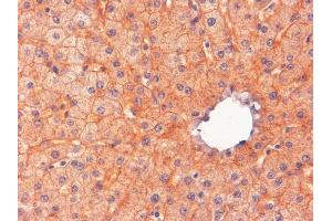 ABIN2562424 (2µg/ml) staining of paraffin embedded Human Liver. (ENPP1 antibody  (C-Term))