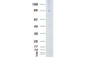 Validation with Western Blot (AXL Protein (Transcript Variant 1) (Myc-DYKDDDDK Tag))