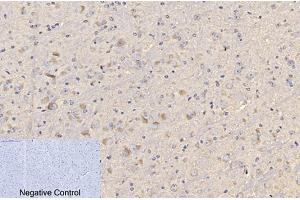 Immunohistochemical analysis of paraffin-embedded mouse brain tissue. (CD4 antibody)