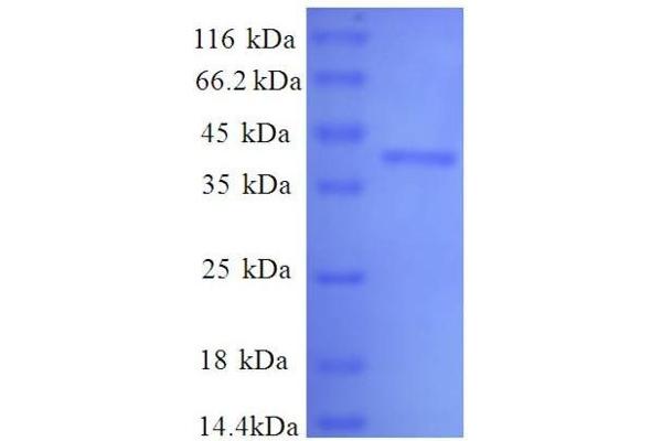 DAD1 Protein (AA 2-113, full length) (GST tag)