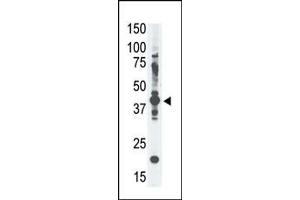 The anti-GE-A4 Pab (ABIN390108 and ABIN2840620) is used in Western blot to detect GE-A4 in  cell lysate. (MAGEA4 antibody  (N-Term))