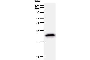 Western Blotting (WB) image for anti-Transcription Factor AP-2 alpha (Activating Enhancer Binding Protein 2 Alpha) (TFAP2A) antibody (ABIN933000) (TFAP2A antibody)