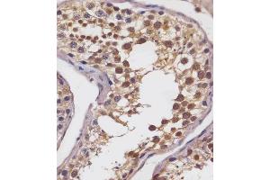 (ABIN6242872 and ABIN6578693) staining SLC2A8 in human testis tissue sections by Immunohistochemistry (IHC-P - paraformaldehyde-fixed, paraffin-embedded sections). (SLC2A8 antibody  (AA 260-292))