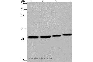 Western blot analysis of 293T and LoVo cell, mouse skin tissue and A172 cell, using ETV7 Polyclonal Antibody at dilution of 1:600 (ETV7 antibody)