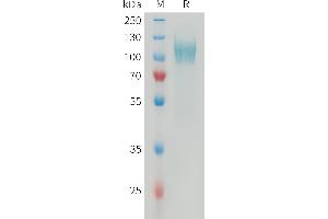Human PDGFRA Protein, His Tag on SDS-PAGE under reducing condition. (PDGFRA Protein (AA 24-528) (His tag))