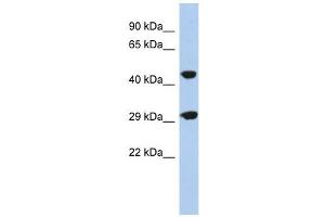 C22ORF25 antibody used at 1 ug/ml to detect target protein. (C22orf25 antibody  (N-Term))