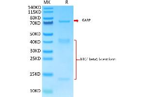 Biotinylated Human GARP&Latent TGF beta Complex on Tris-Bis PAGE under reduced condition. (GARP & Latent TGF beta 1 Complex (AA 20-628) protein (His-Avi Tag,Biotin))