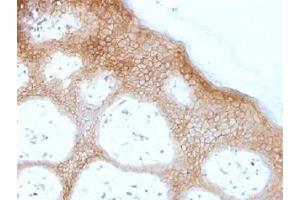 IHC testing of FFPE human skin with Desmoglein 1 antibody (clone DSG1/1733). (Desmoglein 1 antibody  (Internal Region))