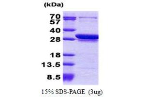 CCDC25 Protein (AA 1-208) (His tag)