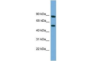 WB Suggested Anti-RFTN2 Antibody Titration: 0. (RFTN2 antibody  (N-Term))