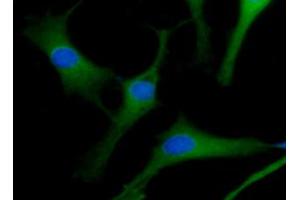 ICC/IF analysis of ACOT7 in U87MG cells line, stained with DAPI (Blue) for nucleus staining and monoclonal anti-human ACOT7 antibody (1:100) with goat anti-mouse IgG-Alexa fluor 488 conjugate (Green). (ACOT7 antibody)