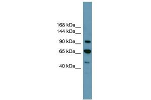 WB Suggested Anti-RB1 Antibody Titration: 0. (Retinoblastoma 1 antibody  (Middle Region))