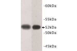 Western Blotting (WB) image for anti-Tubulin, beta (TUBB) (C-Term) antibody (ABIN1854995) (TUBB antibody  (C-Term))