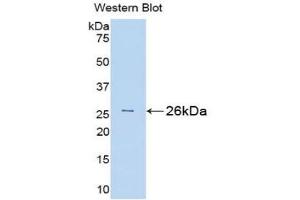 使用BH3相互作用域死亡激动剂（Bid）多克隆抗体（Bid抗体（AA 1-196））检测重组Bid，大鼠