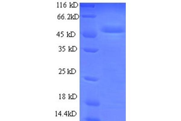 UQCRFS1 Protein (AA 79-274, full length) (GST tag)