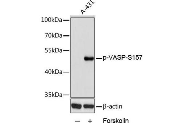 VASP Antikörper  (pSer157)