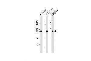 Western Blot at 1:2000 dilution Lane 1: human heart lysate Lane 2: human kidney lysate Lane 3: HepG2 whole cell lysate Lysates/proteins at 20 ug per lane. (Adenylate Kinase 2 antibody  (C-Term))