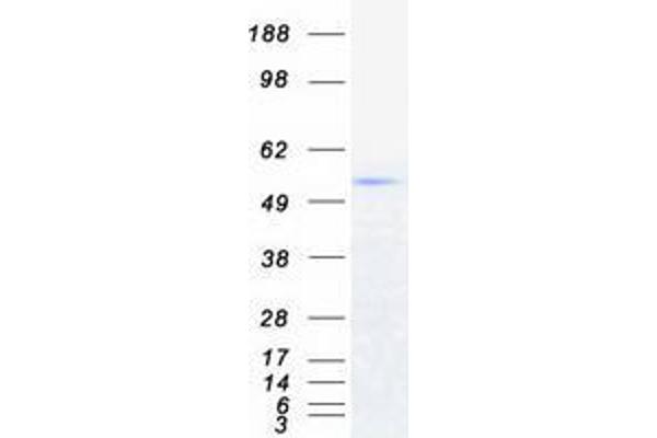 TRIM6 Protein (Transcript Variant 2) (Myc-DYKDDDDK Tag)