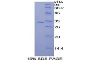 SDS-PAGE (SDS) image for CD2-Associated Protein (Cd2ap) (AA 368-623) protein (His tag) (ABIN2124278) (CD2AP Protein (AA 368-623) (His tag))