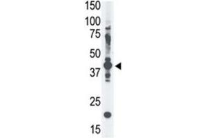 Western Blotting (WB) image for anti-Melanoma Antigen Family A, 4 (MAGEA4) antibody (ABIN3002532) (MAGEA4 antibody)