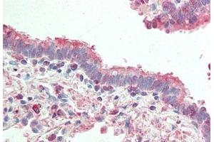 Human Lung, Respiratory Epithelium: Formalin-Fixed, Paraffin-Embedded (FFPE) (ATG4B antibody)