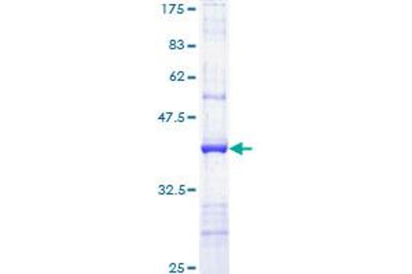 PPARG Protein (AA 366-475) (GST tag)