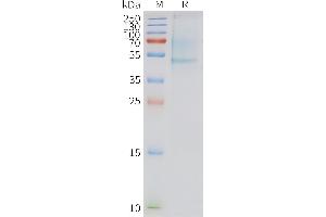 Human APLNR-Nanodisc, Flag Tag on SDS-PAGE (Apelin Receptor Protein (APLNR))