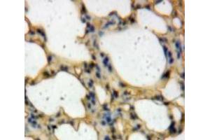 IHC-P analysis of Lung tissue, with DAB staining. (TICAM2 antibody  (AA 34-241))