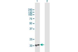 Western Blot analysis of CBFB expression in transfected 293T cell line by CBFB MaxPab polyclonal antibody. (CBFB antibody  (AA 1-187))