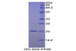 SDS-PAGE (SDS) image for Myelin Oligodendrocyte Glycoprotein (MOG) (AA 30-149) protein (His tag) (ABIN1080330) (MOG Protein (AA 30-149) (His tag))